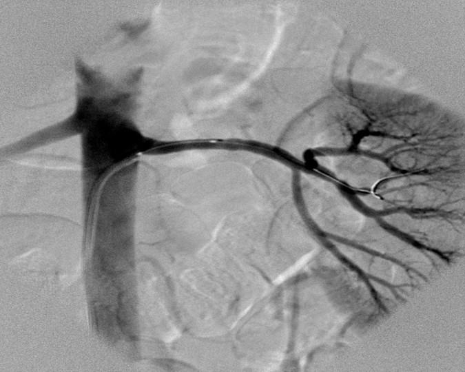 Angiografia