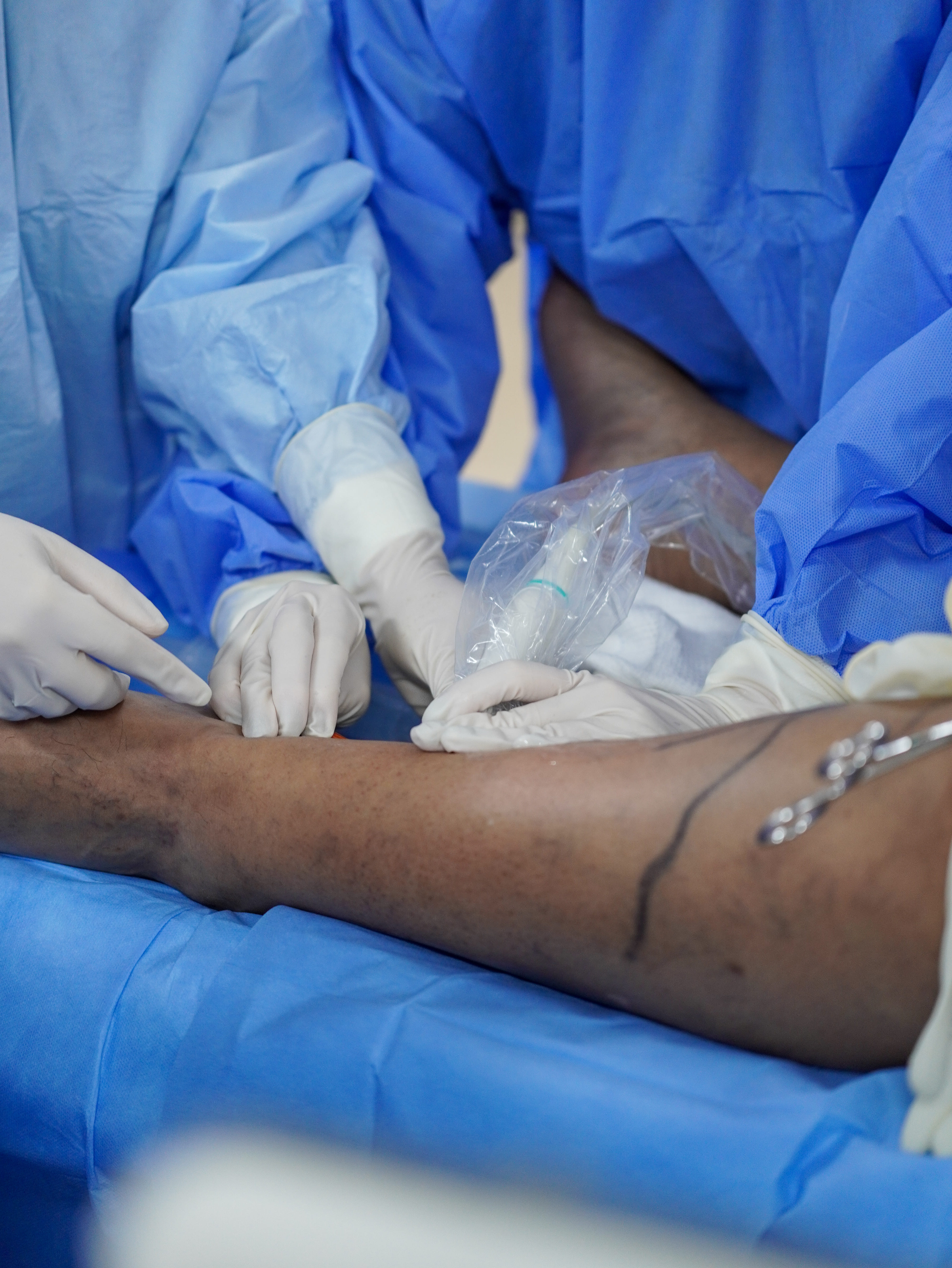 Cirurgia Endovascular