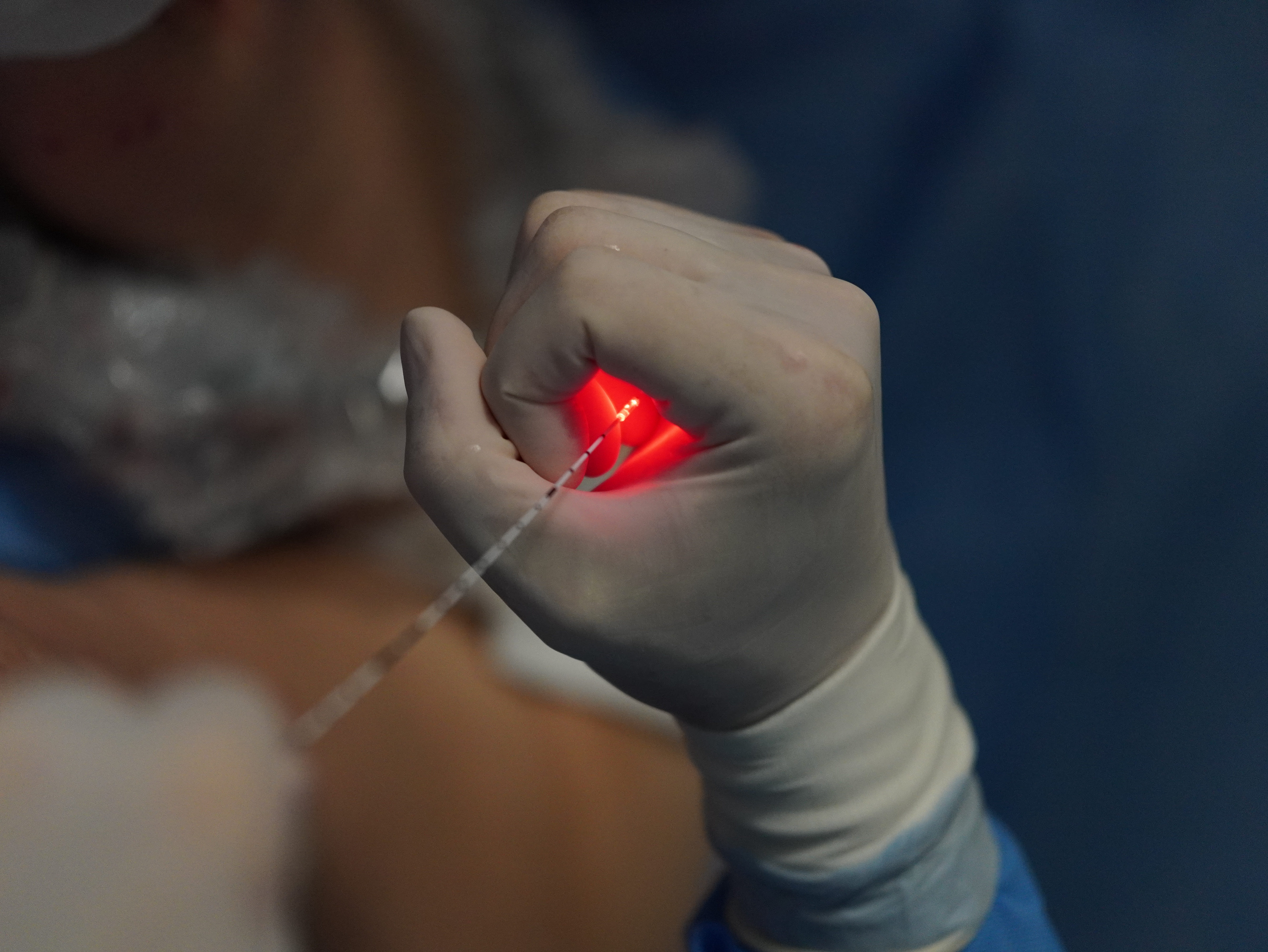 Cirurgia de Varizes a Laser